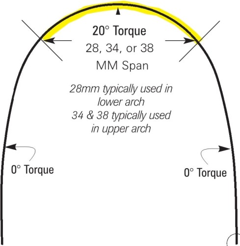 Torqued wire,  łuk torkujący.jpg
