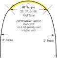 Torqued wire,  łuk torkujący.jpg
