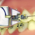 Open-wall straight crimpable hooks 2.jpg