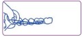 Applicators for intraoral elastics3.jpg